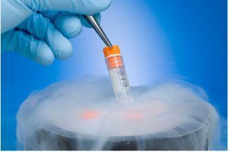 第三代试管婴儿 PGT